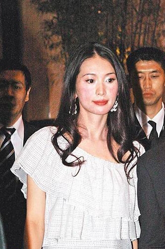 林志玲蔡依林 揭秘明星尷尬的怪病